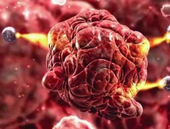 癌症详解,知识、挑战与希望