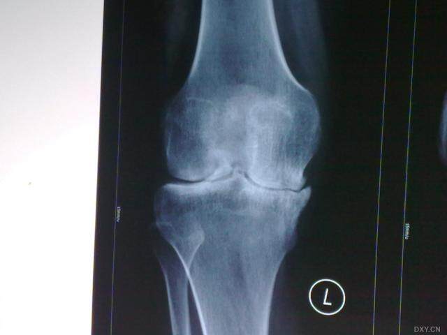 关节炎下的隐秘乐园,小巷特色小店探索