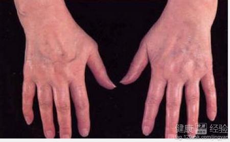 关节炎下的隐秘乐园,小巷特色小店探索